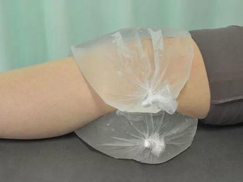 脚崴了图片,紧急处理与康复指南