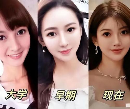 网红业整容,美丽背后的代价与反思